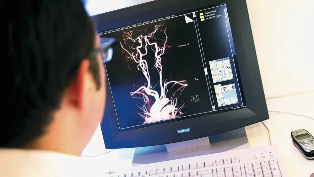 جهاز الرنين المغناطيسي MRI بقوة 3 تسلا لتخطيط الأشعة التداخلية العصبية في مركز أناضولو الطبي